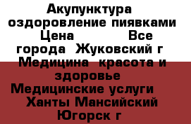 Акупунктура, оздоровление пиявками › Цена ­ 3 000 - Все города, Жуковский г. Медицина, красота и здоровье » Медицинские услуги   . Ханты-Мансийский,Югорск г.